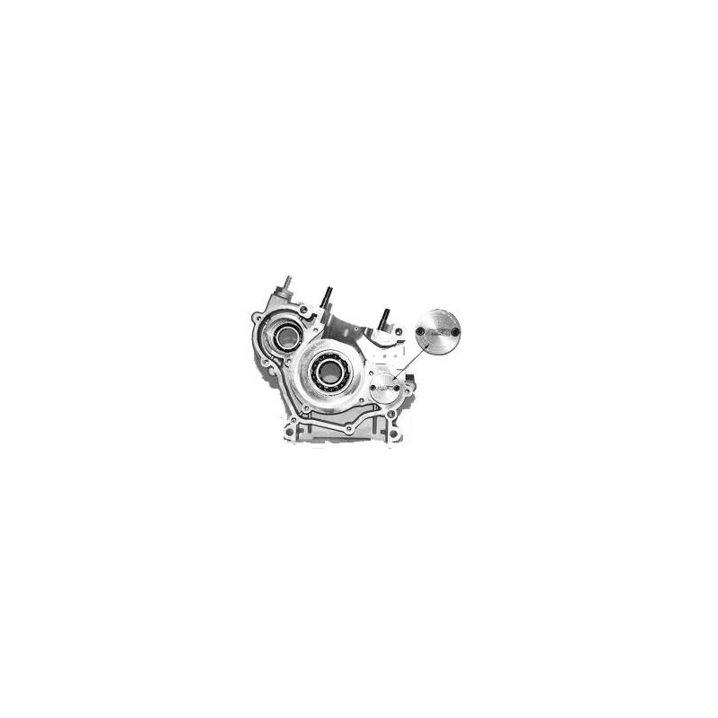 Kit Wasserpumpendeckel Rok - SuperRok - RokGP Vortex